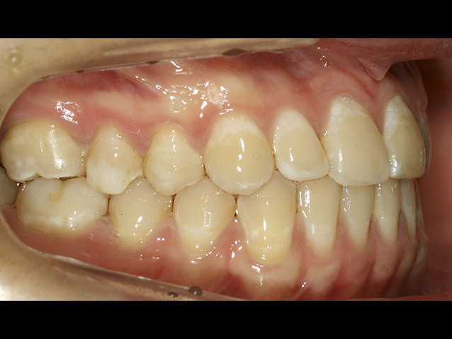 casos-ortodoncia1-1