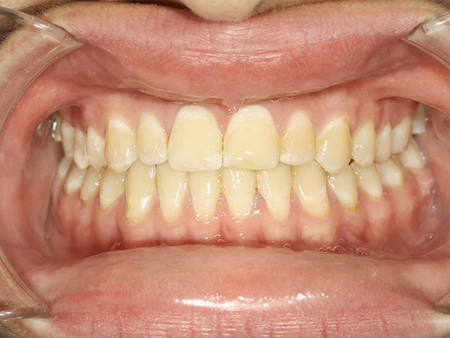 casos-ortodoncia1-2