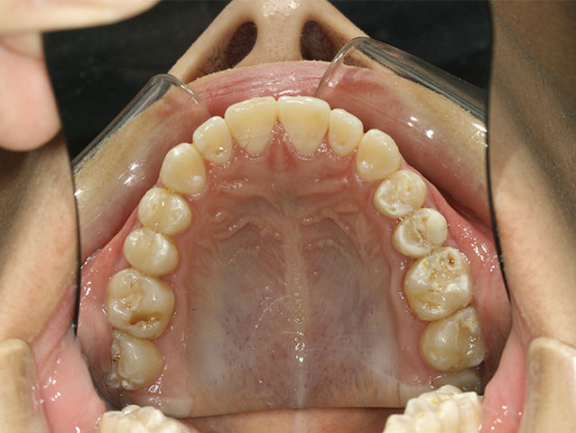 casos-ortodoncia1-4