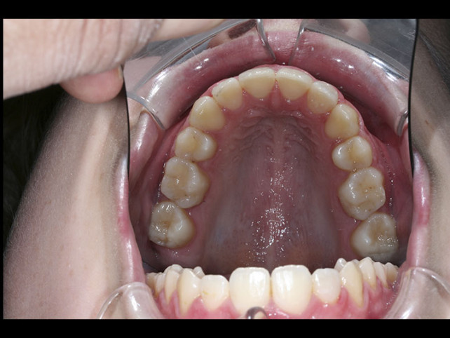 casos-ortodoncia2-8