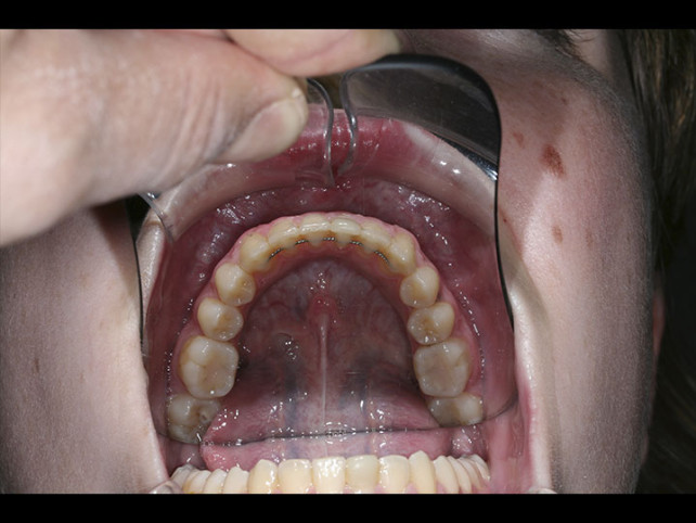 casos-ortodoncia2-9