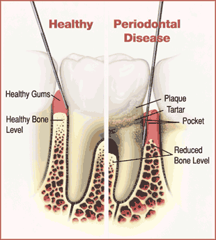 Diagrama del diente - Clínica Dental Sanz&Pancko Barcelona
