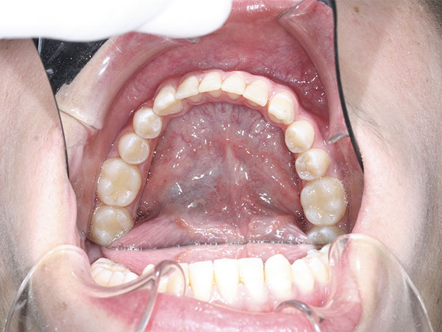 casos-ortodoncia1-10