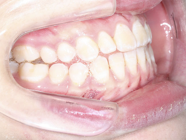 casos-ortodoncia1-7