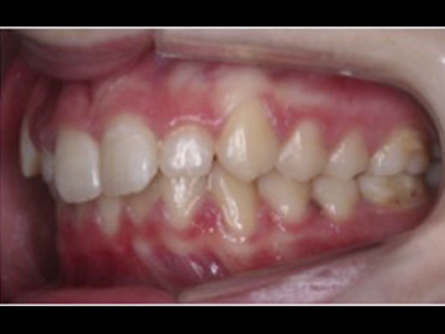 casos-ortodoncia2-3