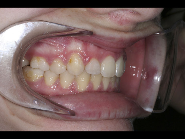 casos-ortodoncia2-6