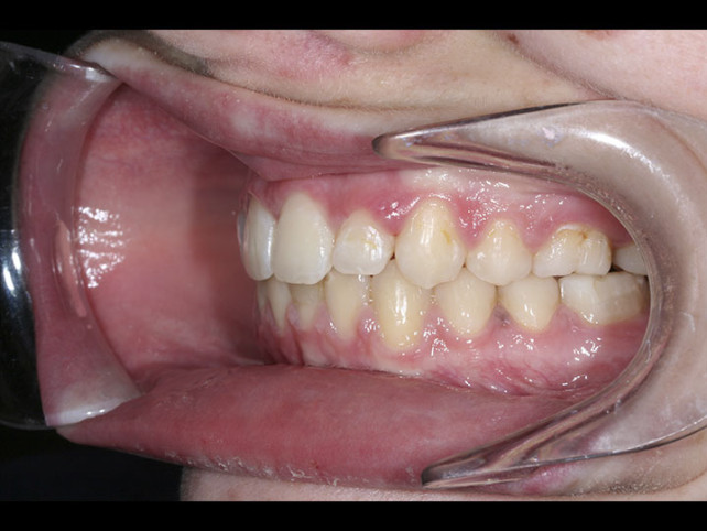 casos-ortodoncia2-7